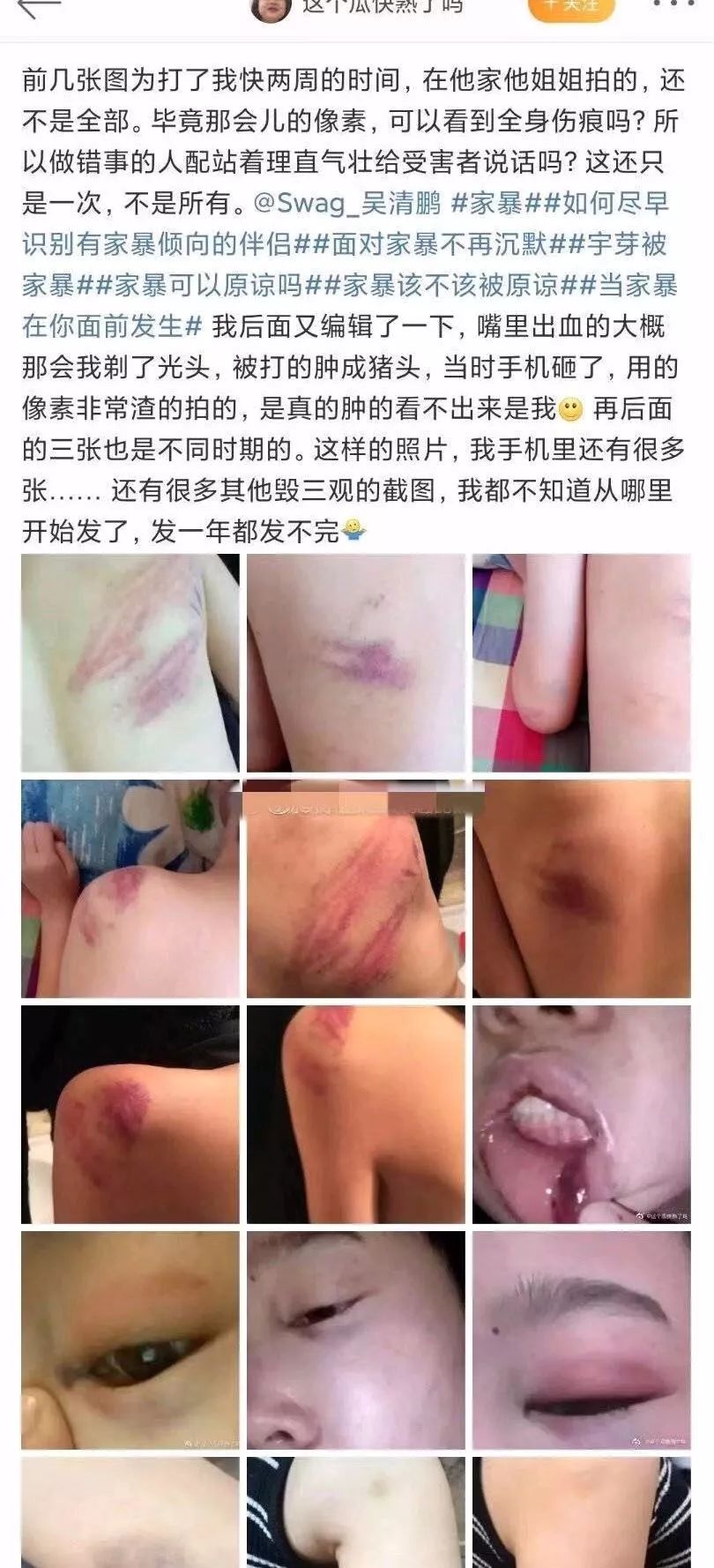 郭美美力挺韩红,郭美美发文控诉