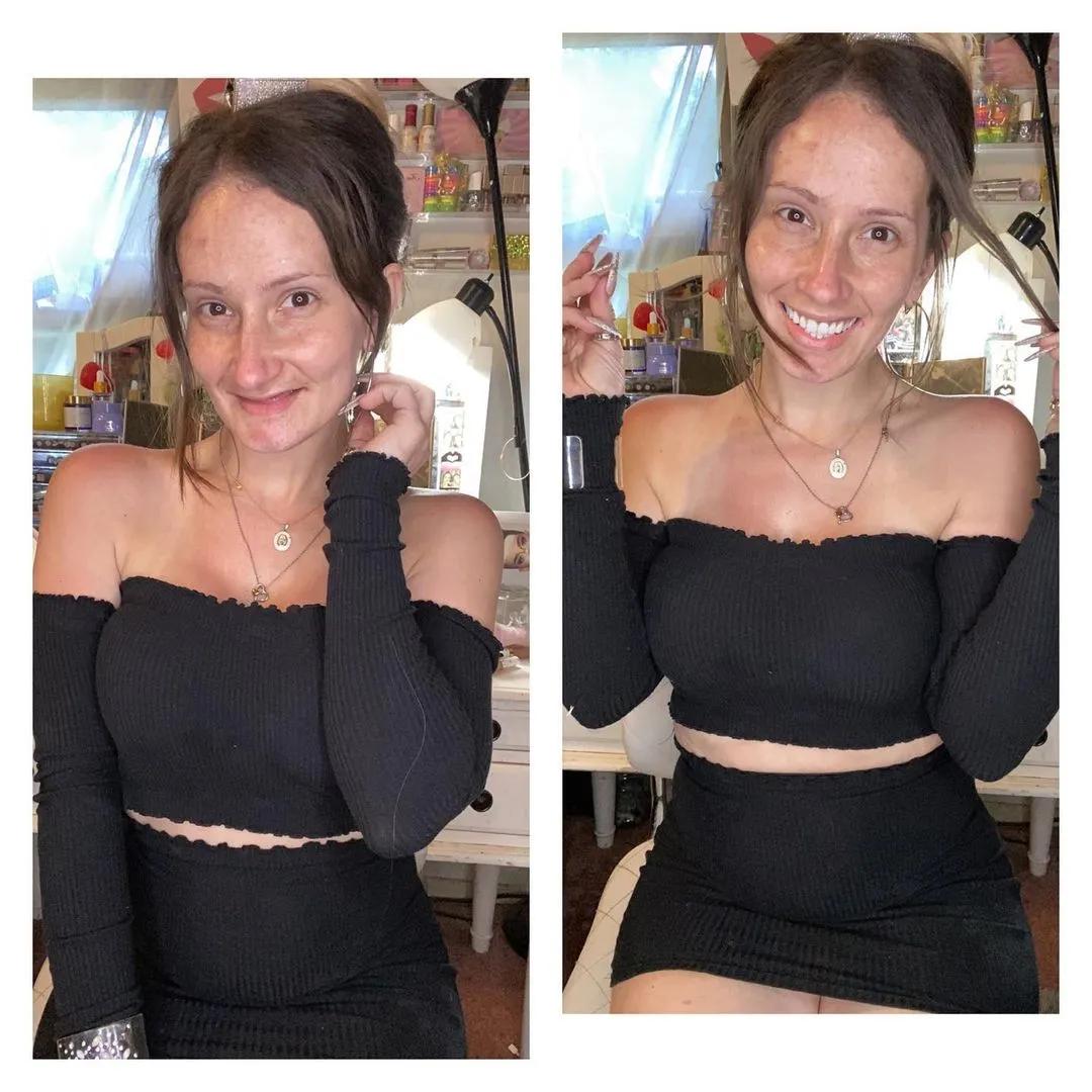 她21岁生娃,9年后牙齿掉光,卸妆惊呆网友:真实的自己最美