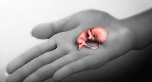 60多天流产下来的胎囊形状,60天流产出来的婴儿感觉到痛吗