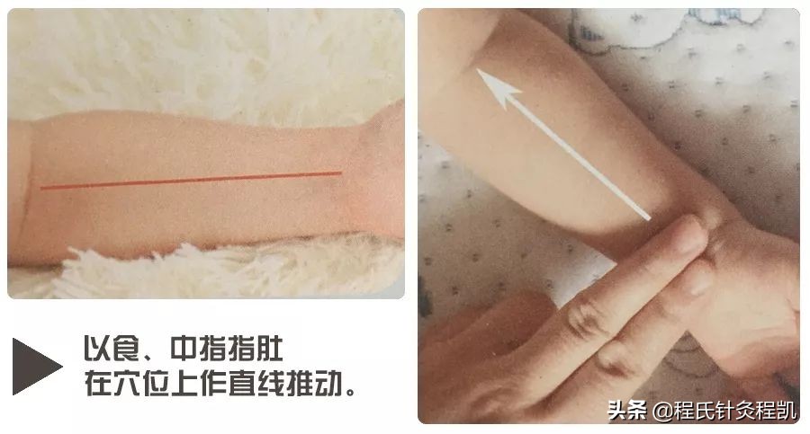 秋季孩子身上起荨麻疹怎么办,秋季小孩出麻疹