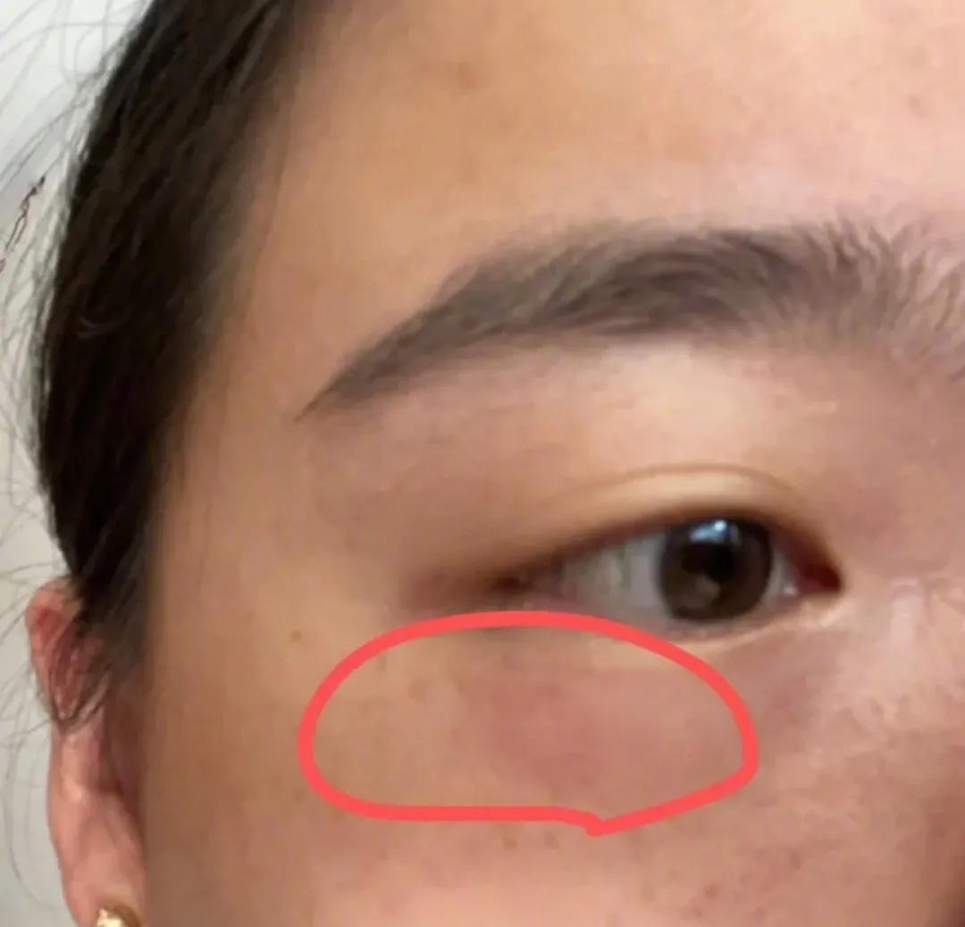 熬夜玩手机女性危害,女生熬夜玩手机导致失明