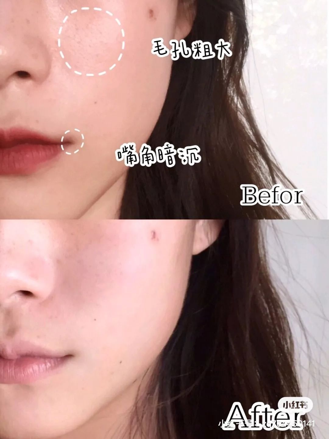 面霜推荐原来它才是干皮亲妈,有被称为干皮亲妈的面霜推荐吗