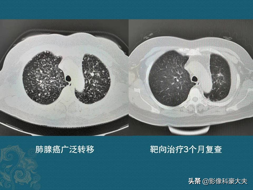 老人病了医生说治不好怎么办,老人有病治不好了要不要告诉他
