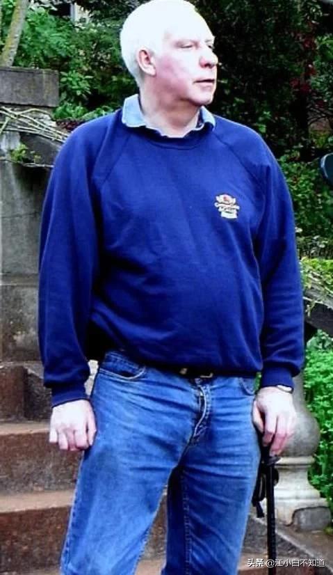 英国男子右腿太短,医生用金属棒和磁铁让他的右腿长了7.6厘米