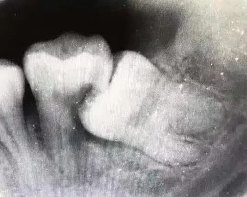 美国警察跪杀案宣判,美国警察跪杀案例