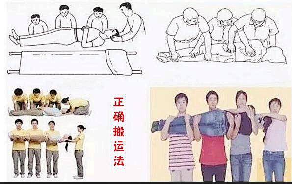 我院脊柱外科应用骨科机器人技术成功救治一名胸12椎体爆裂患者