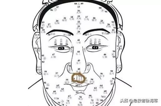 掐人中真有急救作用吗,掐人中可以急救的视频