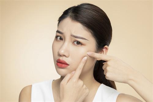 痘博士三招淡化痘印不可不知,痘博士日常护肤防斑的注意事项