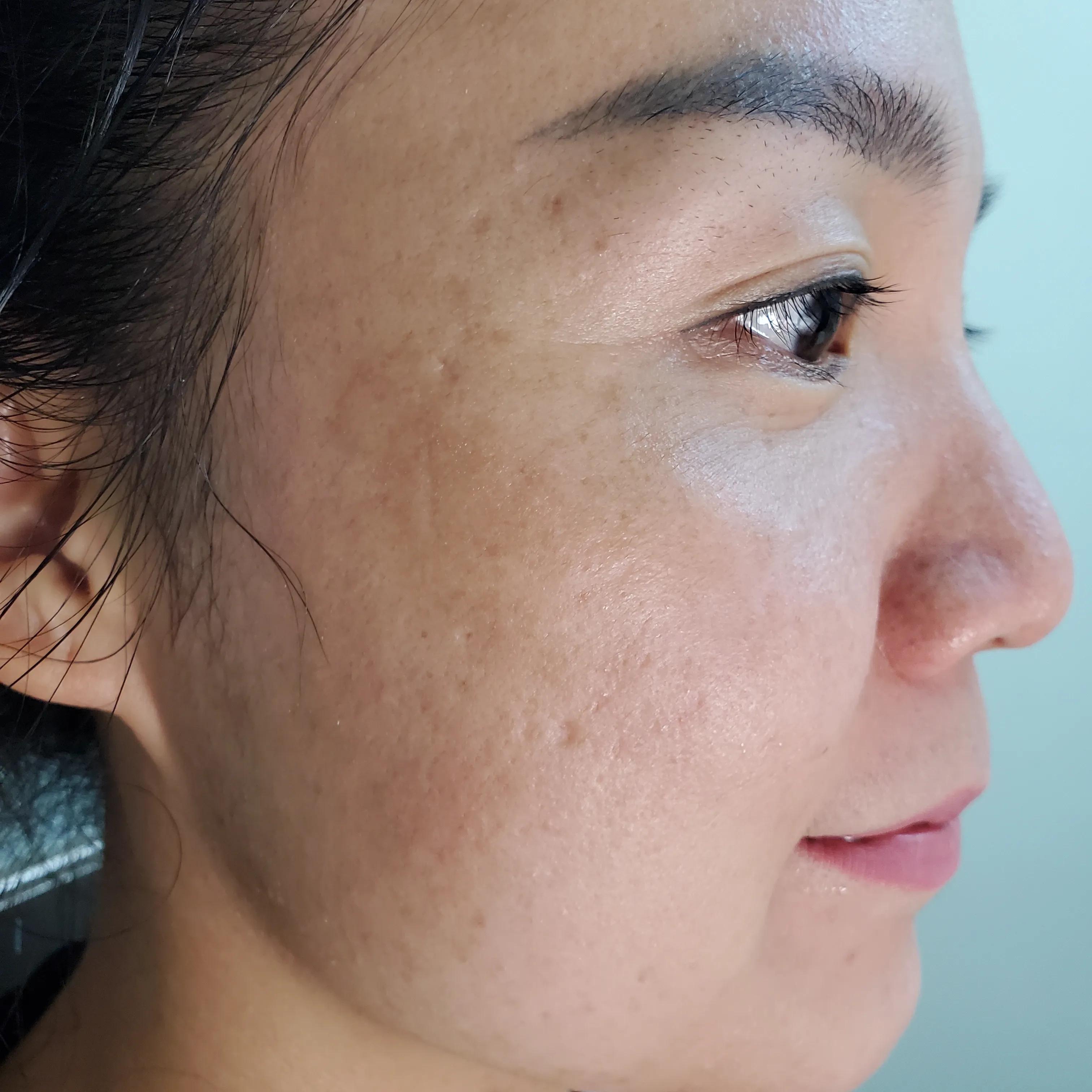 祛斑是真的吗,祛斑的是真的有效还是假的有效