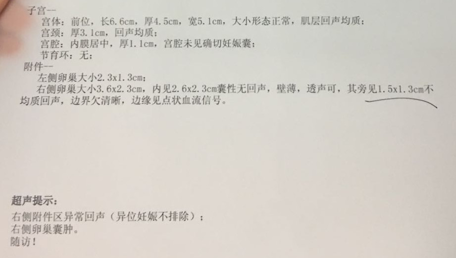 2次宫外孕的心酸,左右两侧都有过宫外孕的经历