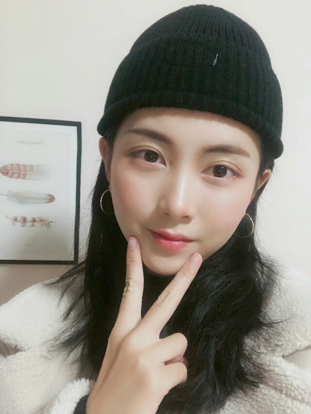 鼻子很高很挺的隆鼻案例,3万元左右的隆鼻效果图