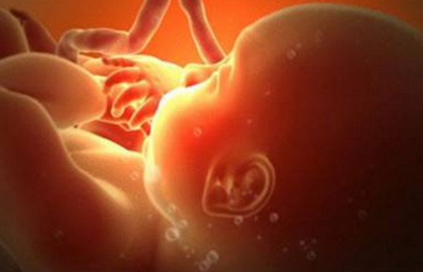 为什么胎水叫羊水,包裹胎儿的水为什么叫羊水