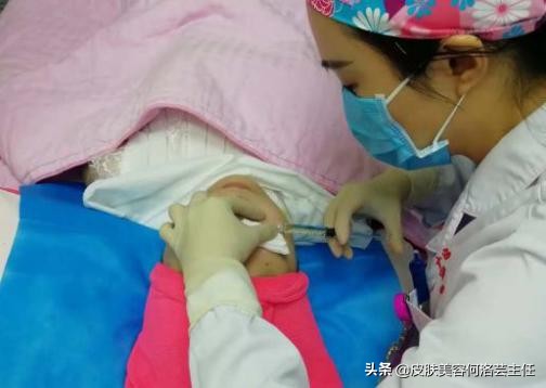 水光针的十问十答,长效水光针和短效水光针怎么样