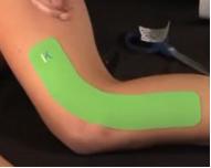 鹅趾肌腱滑囊炎还能跑步吗,跑步滑囊炎一般要休息多久