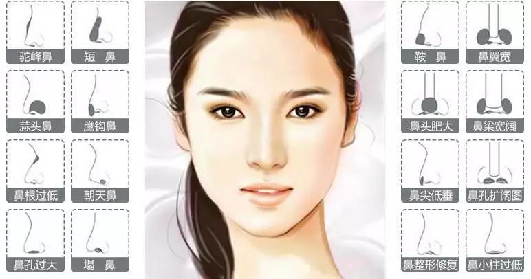 隆鼻慎重,选择整形医院注意什么