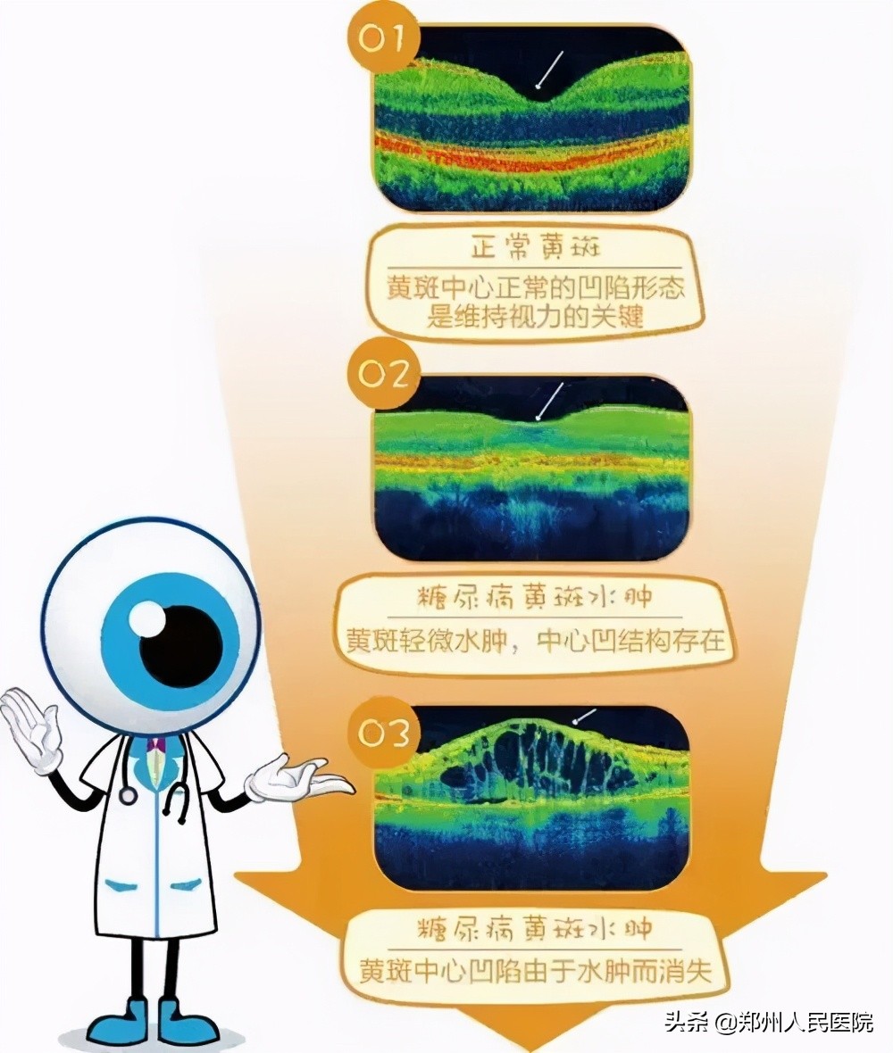 只有加倍爱护Ta，才能更清晰的看世界