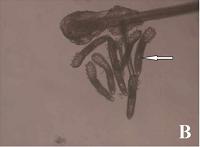 眼部螨虫，心灵窗户中不可忽视的隐秘角落，药师教您轻松预防治疗