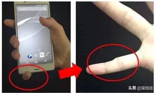 瑜伽练习中手腕痛应该这样处理