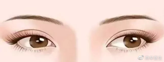 科普篇眼部整形的七大误区,关于眼整形这些事你一定要知道