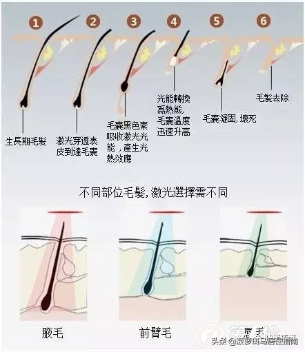 又实用又简单的脱毛办法,脱毛干货