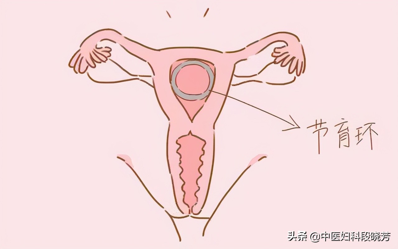 月经淋漓不尽西医怎么说,专家视频讲月经淋漓不尽原因