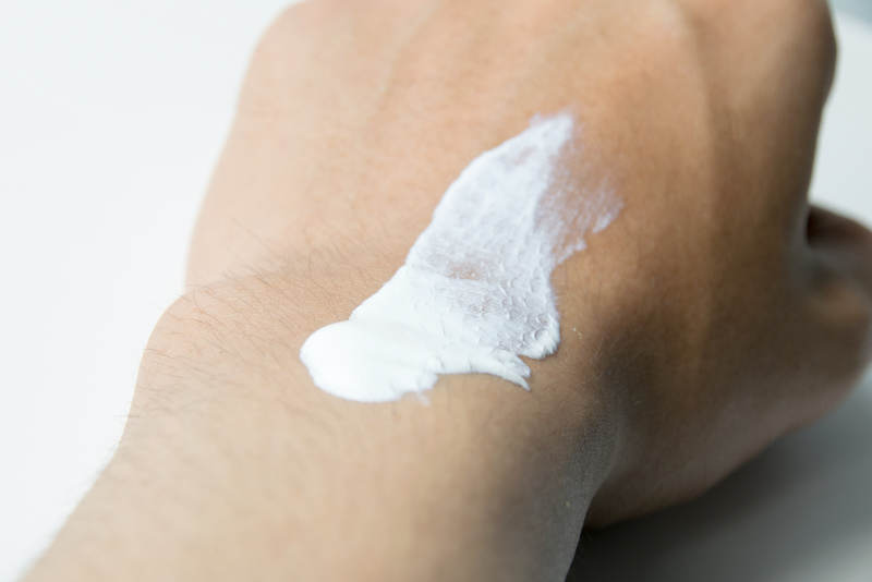 脸上有雀斑怎么消除雀斑,雀斑很常见但要如何祛除才正确