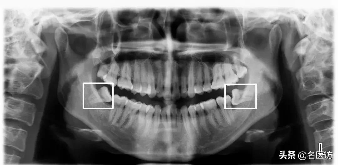 矫正牙科普馆,矫正牙齿科普知识