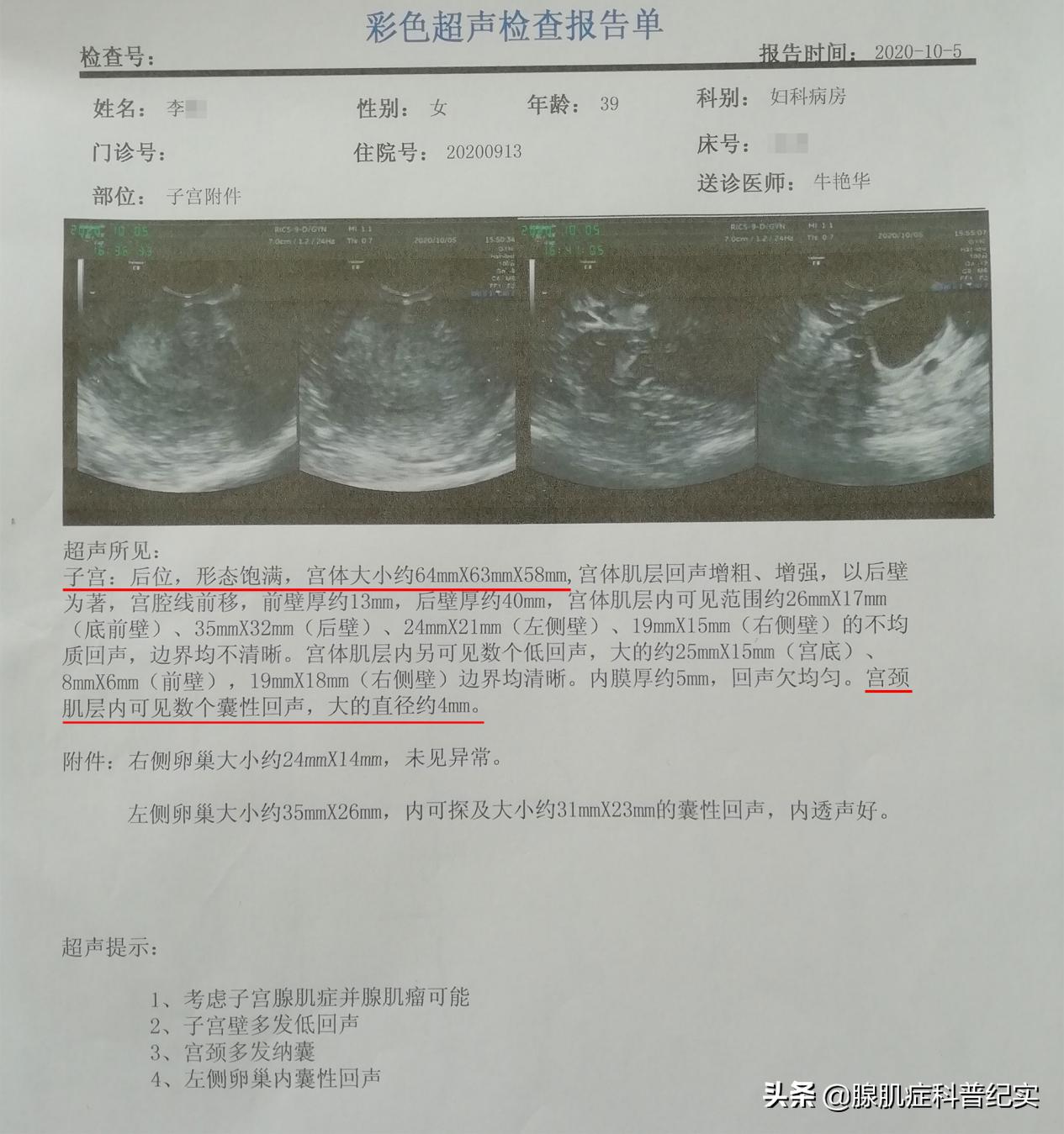 消融手术会导致月经排不出来吗,做消融术得打停经针吗