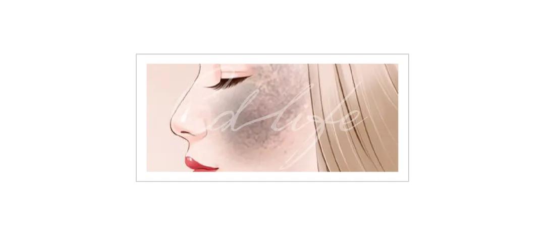 色斑皮肤问题及护肤解决方法,色斑护肤知识