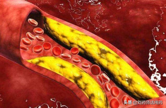 中医治疗冠心病中药方剂,治疗冠心病的中药配方有哪些