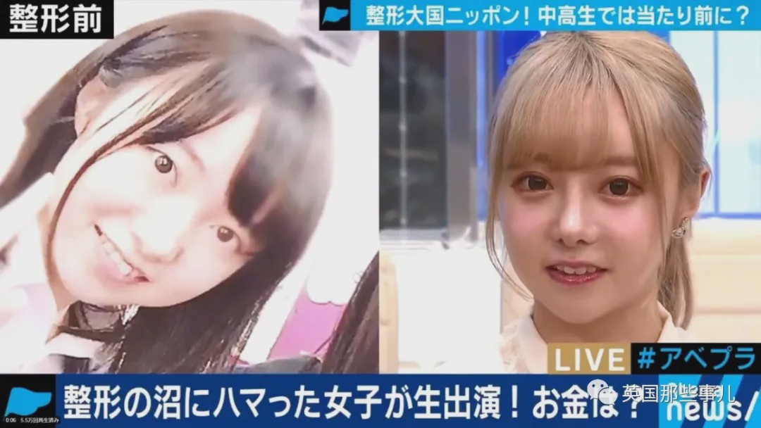 19岁少女整容成60岁大妈,女子花20w整容成网红脸