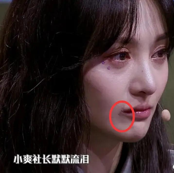 郑爽15年后发生了什么？黑眼圈、暴瘦、畏光、精神失控，就像吸毒