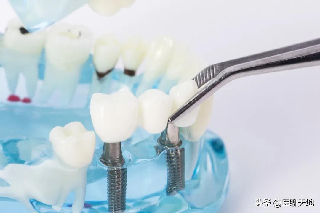 谈医论症|老王装牙记