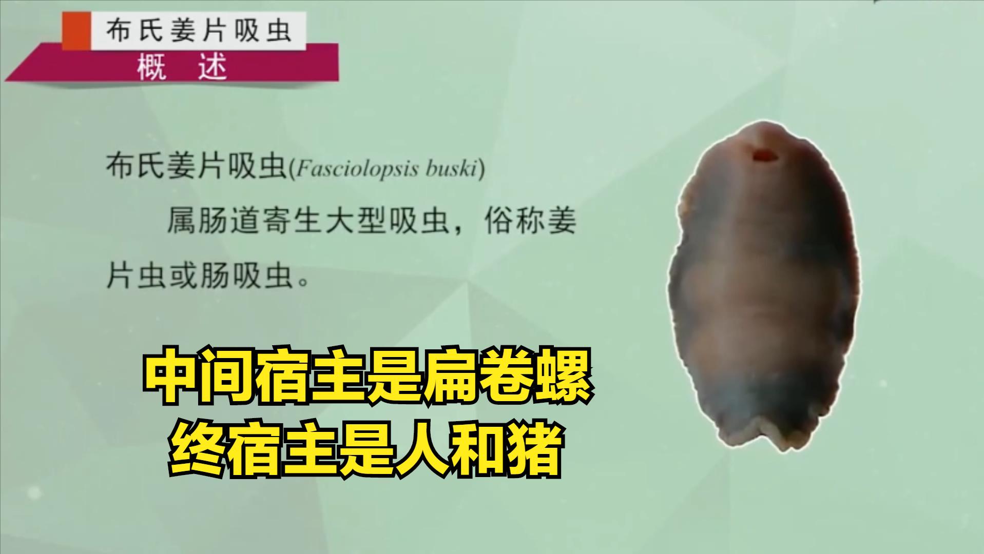 蔬菜中寄生虫的种类和危害,三种蔬菜防止寄生虫