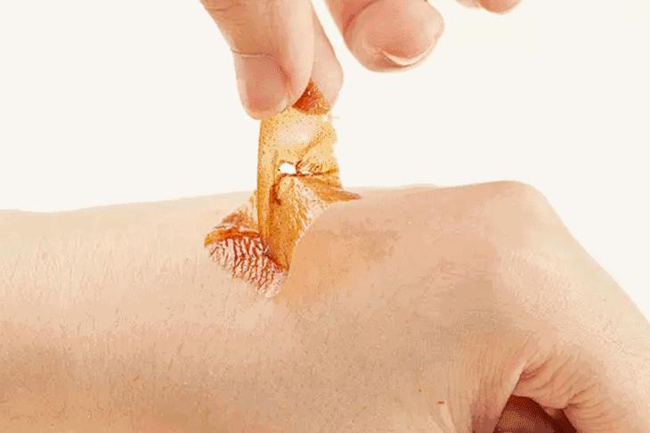 女人下巴凸起,女人下巴摸去一个硬块