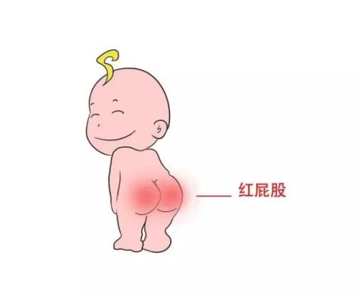 宝宝红屁股是因为纸尿裤质量吗,宝宝红屁股是不是没弄干净啊