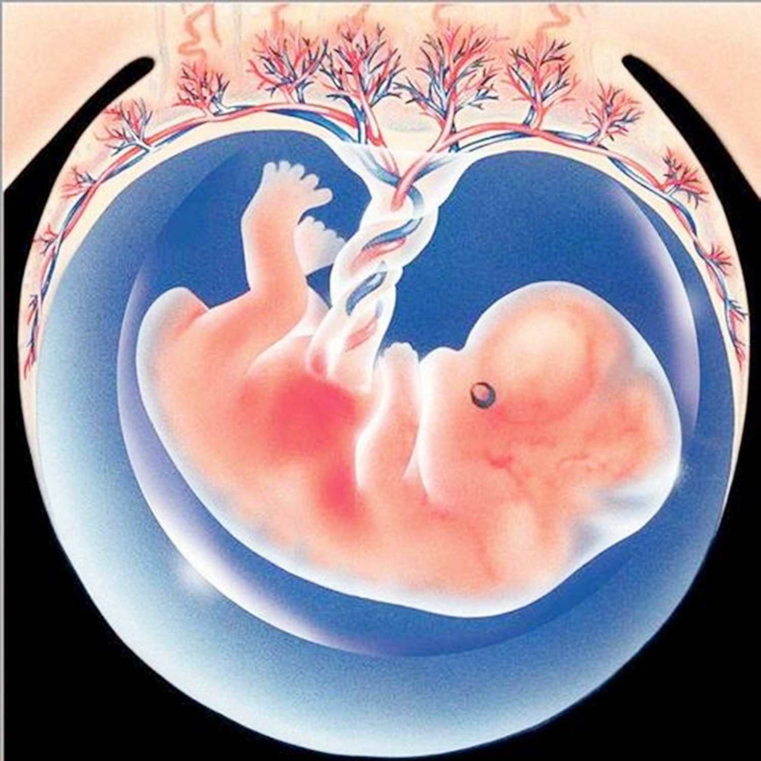 胎儿脐带在母体内断了是为什么,一般是什么原因引起脐带断裂