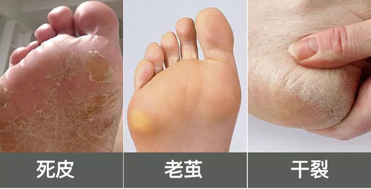 王子文拍照姿势,王子文惊艳泼辣写真