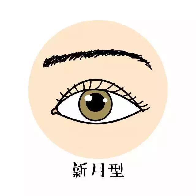 欧式大平行双眼皮什么意思,欧式双眼皮适合什么样的人割