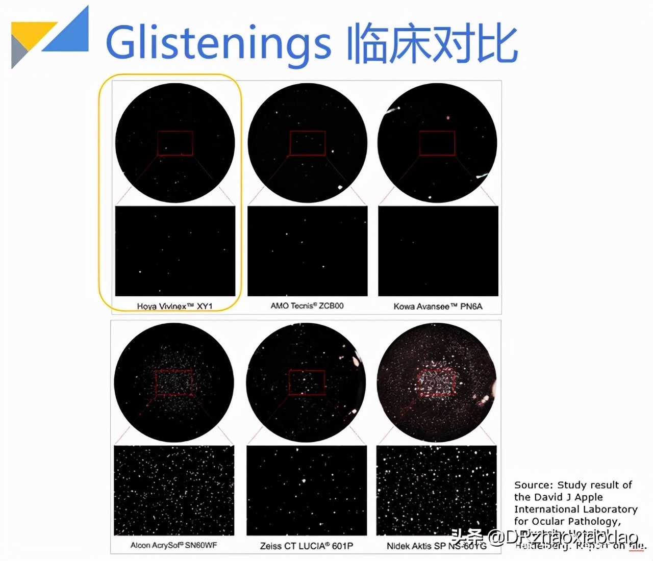 白内障手术应该如何选择人工晶体？人工晶体有什么不同