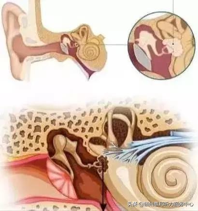 耳硬化症通过什么检查,耳硬化症的诊疗计划