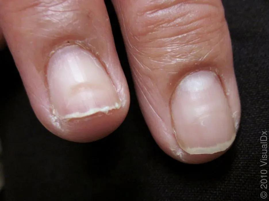 如何不做美甲就能让指甲变得精致,美甲教学指甲的简单基础护理