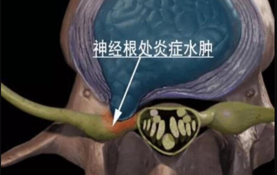 甲钴胺就是b1吗,甲钴胺就是维生素b12吗