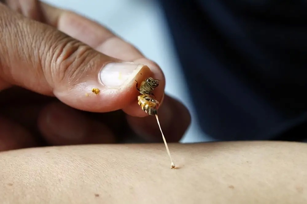 今年被马蜂蜇死多少人,多人被马蜂蜇伤目前已送医治疗