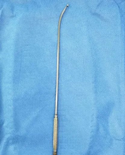 放环取环的步骤和流程,取放环要多久