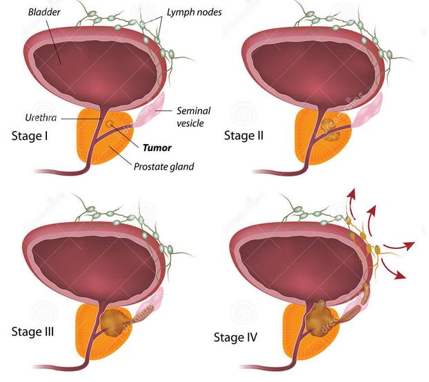 关爱前列腺健康科普大赛,义诊活动关爱老人视频