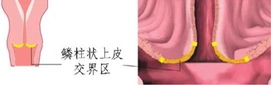 关于宫颈疾病的科普节目,宫颈筛查的注意事项科普视频