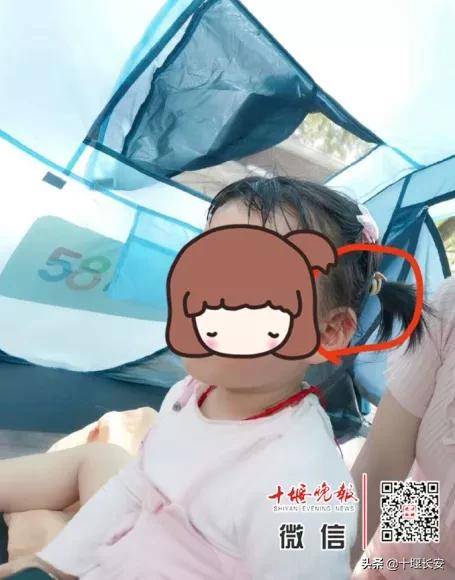 十堰人工耳蜗寻找 (十堰女孩丢人工耳蜗)