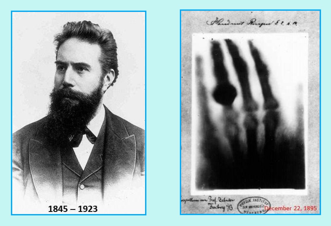 什么是x射线y射线,什么是x射线检测