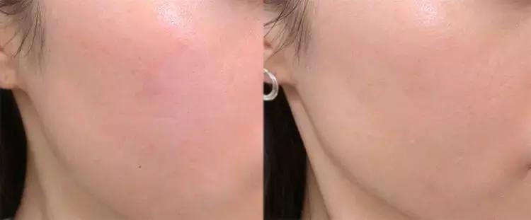 冬天十大遮瑕最好平民粉底液,冬日干皮遮瑕效果好的大牌粉底